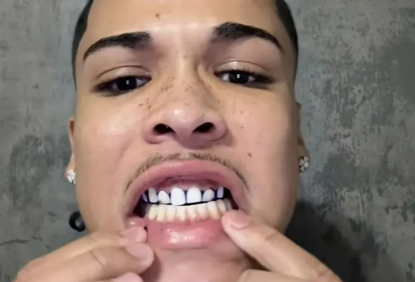 2026TikTok 美区爆款出圈：DRDENT 牙齿美白贴片成跨境美妆新宠