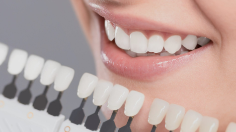 2026TikTok 美区爆款出圈：DRDENT 牙齿美白贴片成跨境美妆新宠